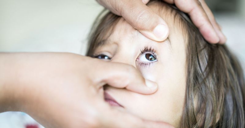 عادة ما يتم علاج Pinkeye في المنزل ، ولكن إليك موعد زيارة الطبيب